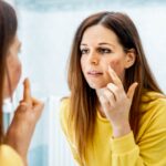 Young woman with problem skin applying treatment cream at home