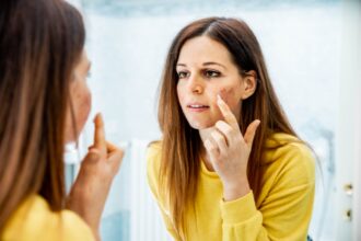 Young woman with problem skin applying treatment cream at home